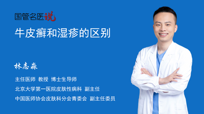 牛皮癣和湿疹的区别