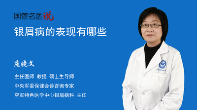 银屑病的表现有哪些