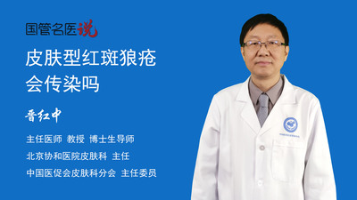 皮肤型红斑狼疮会传染吗