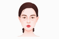 眶隔脂肪释放术
