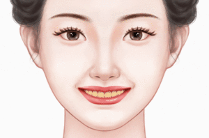 激光美白牙