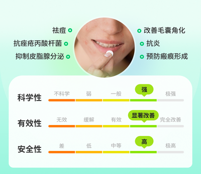 重度痤疮用药指南