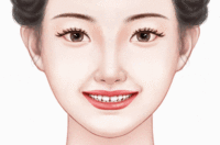 牙齿纠正