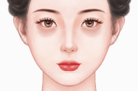 激光祛黑眼圈法