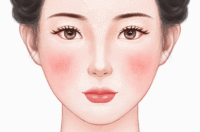激光去红血丝法