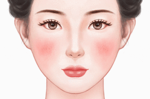 激光去红血丝法