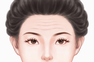 去抬头纹