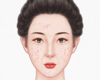 点阵激光