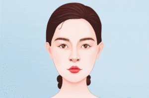 手术缩鼻翼