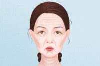Fotona4D Pro欧洲之星