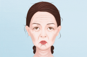 Fotona4D Pro欧洲之星