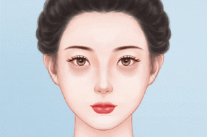 祛除黑眼圈