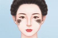 去褐青色痣