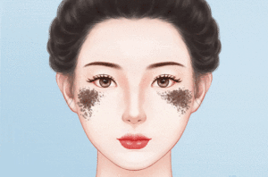 去褐青色痣