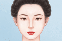 去鲜红斑痣