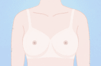 半永久乳晕漂红