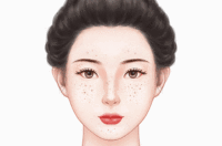 超皮秒激光祛斑