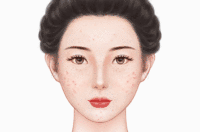 彩光嫩肤术