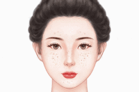 超光子祛斑