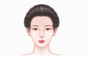 面部充填术
