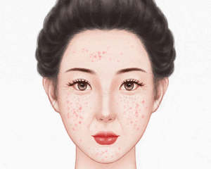 像素激光