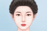 激光脱发际线