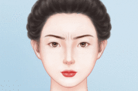 去眉间纹