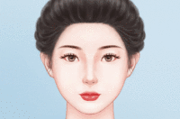 发际线脱毛