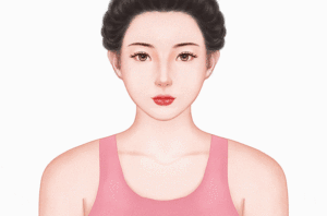 吸脂瘦肩膀