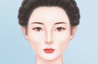 玻尿酸丰苹果肌