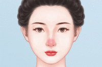 激光治疗酒糟鼻