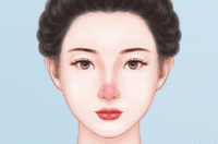 光子治疗酒糟鼻