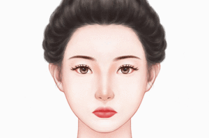 微笑唇整形
