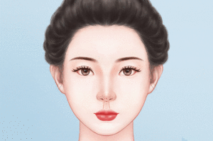 人中缩短术