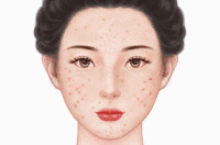 化学换肤