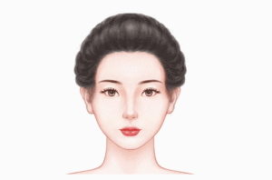 假体隆颞术