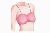 乳房下垂矫正