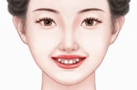 虎牙矫正