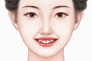 虎牙矫正