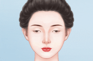 上睑下垂矫正