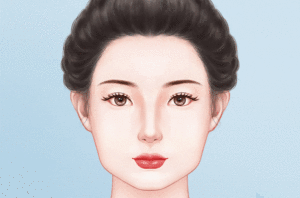 下颌角整形术
