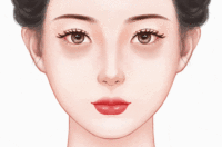 嗨体淡化黑眼圈