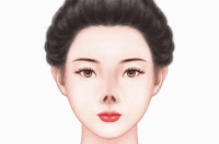 鼻尖缺损修复
