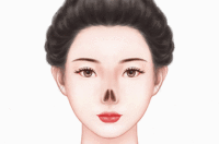 鼻再造术