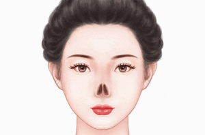 鼻再造术