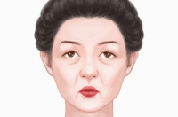 光子除皱