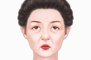 光子除皱