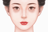 光子嫩肤去黑眼圈