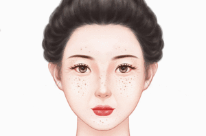 皮秒激光净肤术