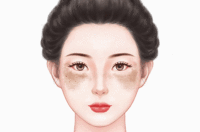 去晒斑
